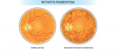 Photos of Eye Stem Cell Center